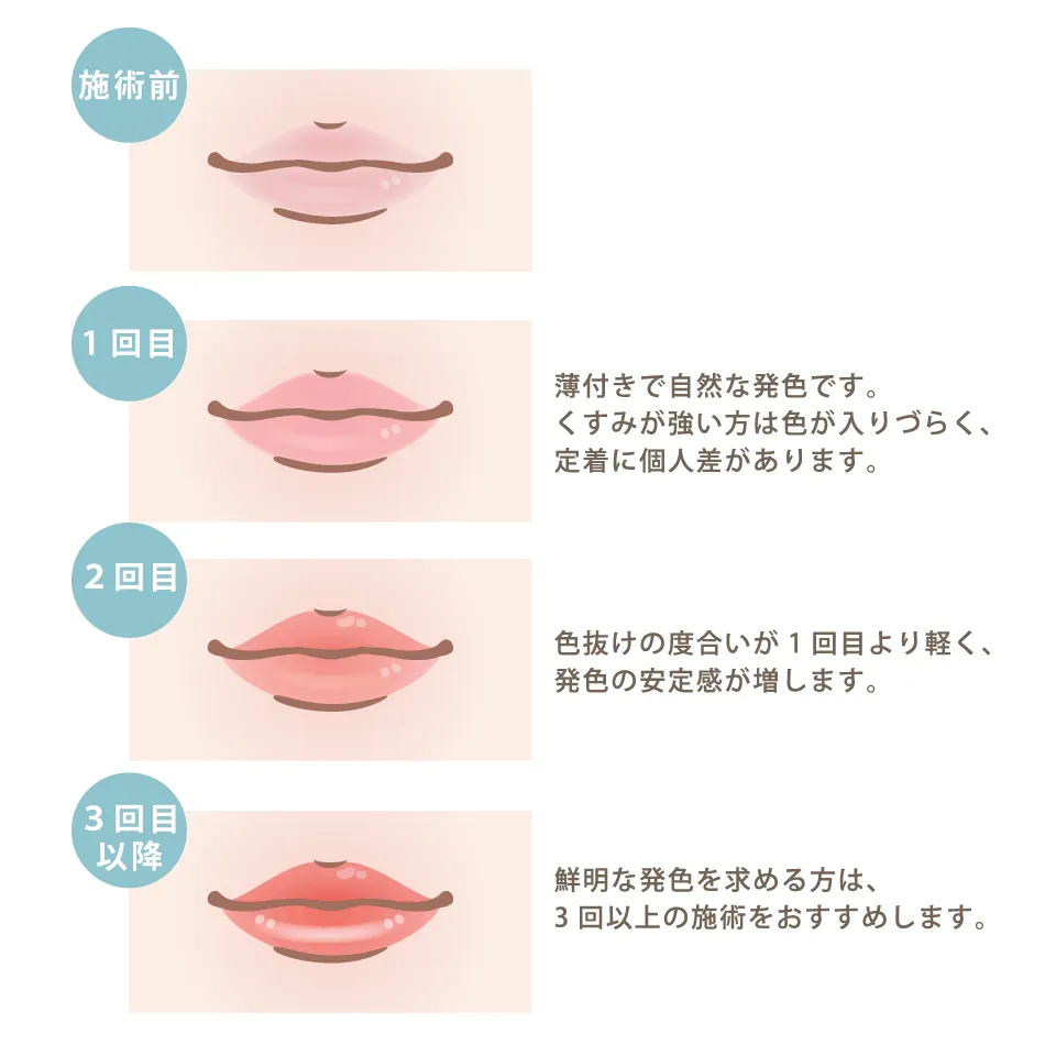 リップアートメイクの施術回数ごとの仕組み