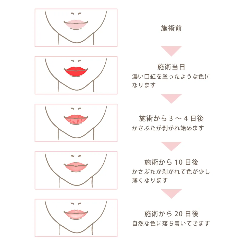 リップアートメイクの色味の定着と変化